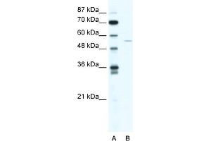 WB Suggested Anti-ZNF289 Antibody Titration:  1. (arfgap2 抗体  (N-Term))