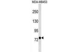 Western Blotting (WB) image for anti-Chromosome 9 Open Reading Frame 3 (C9orf3) antibody (ABIN2999510) (C9orf3 抗体)