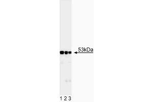 Western blot analysis of desmin. (Desmin 抗体)