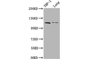 Western Blot Positive WB detected in: THP-1 whole cell lysate, Mouse lung tissue All lanes: MDA5 antibody at 1:2000 Secondary Goat polyclonal to rabbit IgG at 1/50000 dilution Predicted band size: 117, 26 kDa Observed band size: 117 kDa (Recombinant IFIH1 抗体)