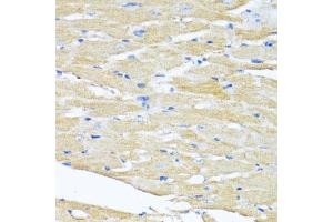 Immunohistochemistry (IHC) image for anti-Hydroxysteroid (17-Beta) Dehydrogenase 1 (HSD17B1) (AA 1-328) antibody (ABIN6142002)