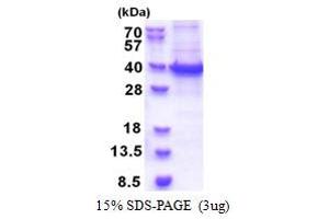 SDS-PAGE (SDS) image for RNA Binding Motif Protein 11 (RBM11) (AA 1-281) protein (His tag) (ABIN5853418) (RBM11 Protein (AA 1-281) (His tag))