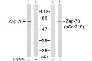 Image no. 2 for anti-zeta-Chain (TCR) Associated Protein Kinase 70kDa (ZAP70) (Tyr319) antibody (ABIN197385) (ZAP70 抗体  (Tyr319))