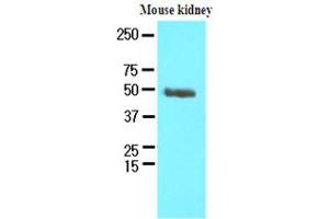 Western Blotting (WB) image for anti-Proteasome (Prosome, Macropain) 26S Subunit, Non-ATPase, 11 (PSMD11) (AA 1-422), (N-Term) antibody (ABIN371887) (PSMD11 抗体  (N-Term))