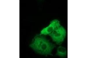 Anti-TACC3 mouse monoclonal antibody (ABIN2453830) immunofluorescent staining of COS7 cells transiently transfected by pCMV6-ENTRY TACC3 (RC210754). (TACC3 抗体)