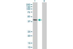 Western Blot analysis of IVD expression in transfected 293T cell line by IVD MaxPab polyclonal antibody. (IVD 抗体  (AA 1-423))
