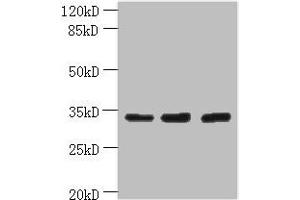 Western blot All lanes: OTUD6B antibody at 4 μg/mL Lane 1: PC-3 whole cell lysate Lane 2: 293T whole cell lysate Lane 3: MDA-MB-231 whole cell lysate Secondary Goat polyclonal to rabbit IgG at 1/10000 dilution Predicted band size: 34, 22 kDa Observed band size: 34 kDa (OTUD6B 抗体  (AA 1-293))