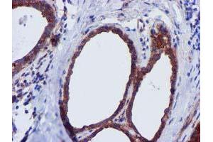 Immunohistochemical staining of paraffin-embedded Human breast tissue using anti-EPN2 mouse monoclonal antibody. (Epsin 2 抗体)