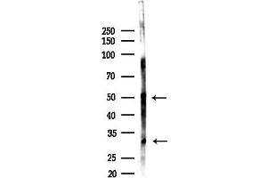 anti-Sphingosine-1-Phosphate Phosphatase 1 (SGPP1) antibody