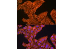 Immunofluorescence (IF) image for anti-Signal Recognition Particle 54kDa (SRP54) antibody (ABIN1682276)