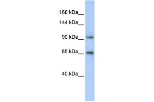 WB Suggested Anti-CCDC52 Antibody Titration: 0. (SPICE1 抗体  (Middle Region))