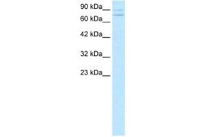 ZNF81 antibody (20R-1073) used at 0. (ZNF81 抗体  (Middle Region))