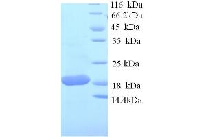 SDS-PAGE (SDS) image for Tumor Necrosis Factor alpha (TNF alpha) (AA 78-234) protein (His tag) (ABIN5713900)