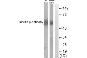 Western blot analysis of extracts from rat brain and mouse brain cells, using Tubulin beta antibody. (TUBB 抗体  (C-Term))