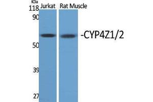 anti-CYP4Z1/2 (Internal Region) antibody
