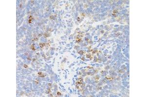 Immunohistochemistry of paraffin-embedded Mouse spleen using TNFRSF13B Polyclonal Antibody at dilution of 1:100 (40x lens). (TACI 抗体)