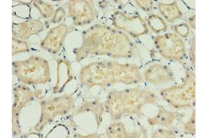Immunohistochemistry of paraffin-embedded human kidney tissue using ABIN7143208 at dilution of 1:100 (ACBD4 抗体  (AA 1-305))