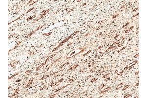 Immunohistochemistry analysis using Rabbit Anti-FNP1 Polyclonal Antibody (ABIN5066843).