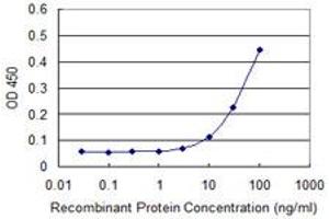 Detection limit for recombinant GST tagged ZAK is approximately 10ng/ml as a capture antibody. (ZAK 抗体  (AA 1-455))