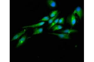 Immunofluorescence staining of Hela cells with ABIN7164423 at 1:100, counter-stained with DAPI. (HECTD2 抗体  (AA 674-776))