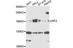 Western blot analysis of extracts of various cells, using INF2 antibody. (INF2 抗体)