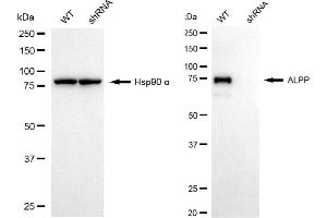 Western blotting analysis using ALPP antibody (ABIN7799842).