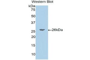 Western Blotting (WB) image for anti-Jagged 1 (JAG1) (AA 33-250) antibody (ABIN1175042) (JAG1 抗体  (AA 33-250))