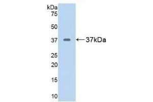 Detection of Recombinant ARG, Rat using Polyclonal Antibody to Arginase (ARG) (ARG 抗体  (AA 1-323))
