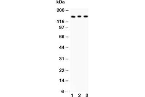 Western blot testing of Insulin Receptor antibody and Lane 1:  rat kidney;  2: PANC;  3: HeLa (Insulin Receptor 抗体  (AA 1353-1372))