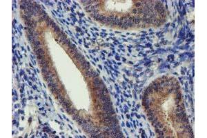 Immunohistochemical staining of paraffin-embedded Human endometrium tissue using anti-DCLRE1B mouse monoclonal antibody. (DCLRE1B 抗体  (AA 1-280))
