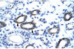 Human kidney; GTF2F2 antibody - C-terminal region in Human kidney cells using Immunohistochemistry (GTF2F2 抗体  (C-Term))