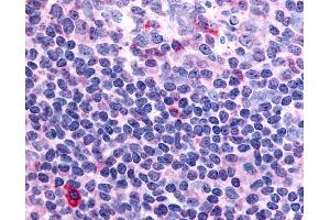Anti-Thrombin Receptor antibody IHC of human tonsil. (PAR1 抗体  (N-Term))