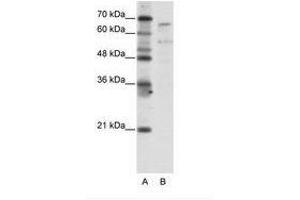 Image no. 1 for anti-TAF6-Like RNA Polymerase II, P300/CBP-Associated Factor (PCAF)-Associated Factor, 65kDa (TAF6L) (N-Term) antibody (ABIN203282) (TAF6L 抗体  (N-Term))