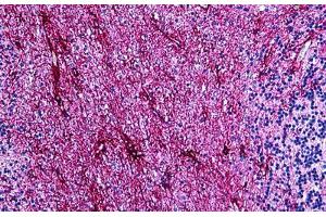 Human Brain, Cerebellum: Formalin-Fixed, Paraffin-Embedded (FFPE) (GFAP 抗体)