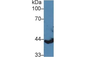 Western blot analysis of Pig Spleen lysate, using Human KRT13 Antibody (5 µg/ml) and HRP-conjugated Goat Anti-Rabbit antibody ( (Cytokeratin 13 抗体  (AA 104-403))