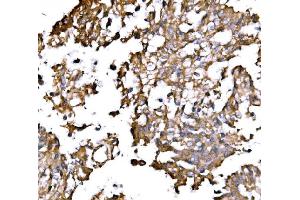IHC analysis of IRBIT/AHCYL1 using anti-IRBIT/AHCYL1 antibody (ABIN7600030). (AHCYL1 抗体  (AA 14-57))
