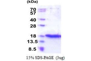 Zymogen Granule Protein 16 (ZG16) (AA 17-167) protein (His tag)