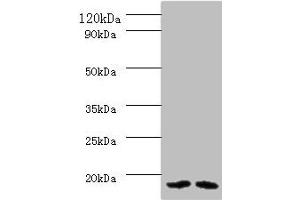 Western blot All lanes: PAM16 antibody at 2 μg/mL Lane 1: HL60 whole cell lysate Lane 2: HepG2 whole cell lysate Secondary Goat polyclonal to rabbit IgG at 1/10000 dilution Predicted band size: 14 kDa Observed band size: 14 kDa (MAGMAS 抗体  (AA 1-125))