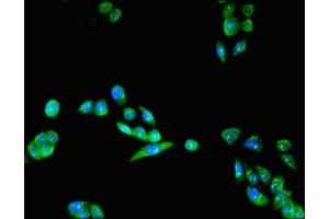 Immunofluorescent analysis of PC-3 cells using ABIN7158756 at dilution of 1:100 and Alexa Fluor 488-congugated AffiniPure Goat Anti-Rabbit IgG(H+L) (LYPLAL1 抗体  (AA 2-237))