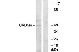 Western blot analysis of extracts from RAW264. (Cell Adhesion Molecule 4 抗体  (C-Term))