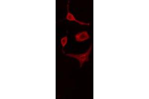 ABIN6269317 staining HuvEc cells by IF/ICC. (Caveolin-1 抗体  (N-Term))