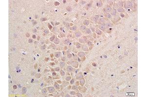 Formalin-fixed and paraffin embedded rat liver tissue labeled with Rabbit Anti-Substance P Polyclonal Antibodyat 1:200 followed by conjugation to the secondary antibody and DAB staining. (Substance P 抗体  (AA 58-68))