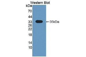 Western blot analysis of the recombinant protein. (CMTM1 抗体  (AA 1-286))