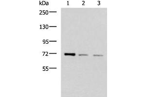 Western blot analysis of K562 HepG2 and Jurkat cell lysates using FOXK1 Polyclonal Antibody at dilution of 1:400 (Foxk1 抗体)