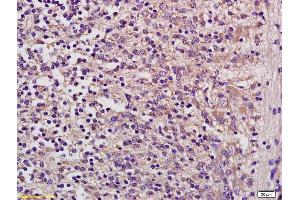 Formalin-fixed and paraffin embedded mouse embryo labeled with Anti GUSB/beta glucuronidase Polyclonal Antibody, Unconjugated (ABIN873149) at 1:200 followed by conjugation to the secondary antibody and DAB staining (Glucuronidase beta 抗体  (AA 589-651))