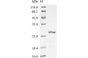 Secreted phosphoprotein 1 (SPP1) (AA 17-167) protein (His tag)