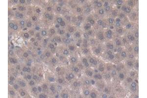 Used in DAB staining on fromalin fixed paraffin- embedded kidney tissue (TNFSF14 抗体  (AA 58-239))