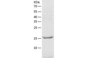 Western Blotting (WB) image for Josephin Domain Containing 1 (JOSD1) (AA 1-202) protein (His tag) (ABIN7287251) (JOSD1 Protein (AA 1-202) (His tag))