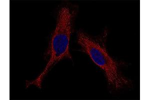 Indirect immunostaining of HELA cells (dilution 1 : 100; red). (Syntaxin 4 抗体  (Cytoplasmic Domain))