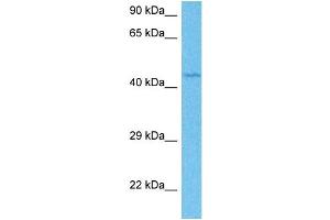 Host:  Rabbit  Target Name:  ETV4  Sample Tissue:  Human Jurkat Whole Cell  Antibody Dilution:  1ug/ml (ETV4 抗体  (Middle Region))